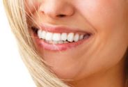estetica dentale